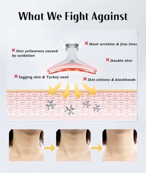 Fastaid Red-Light-Therapy-for-Face and Neck, Red Light Therapy Wand, 7 Color Led Face Neck Massager for Skin Care, White