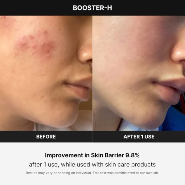 medicube Booster H - Korean Skincare Tool - Facial Glow Booster for Maximizing and Boosting Skin Care Absorption - Needle Free