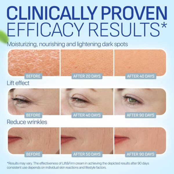 Face & Neck Cream for Tightening and Firming - Hyaluronic Acid 4D, Vitamin E + B5, Elastin - Made in Europe - Lift & Firm Cream - Face Moisturizer Anti Aging Treatment for All Skin