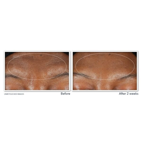 RoC Retinol Correxion Deep Wrinkle Serum Facial Cleanser with Niacinamide for Anti-Aging and Fine Lines, Long-Wear Makeup Remover, Fragrance Free Skin Care, Opthalmologist Tested, 6 Ounces