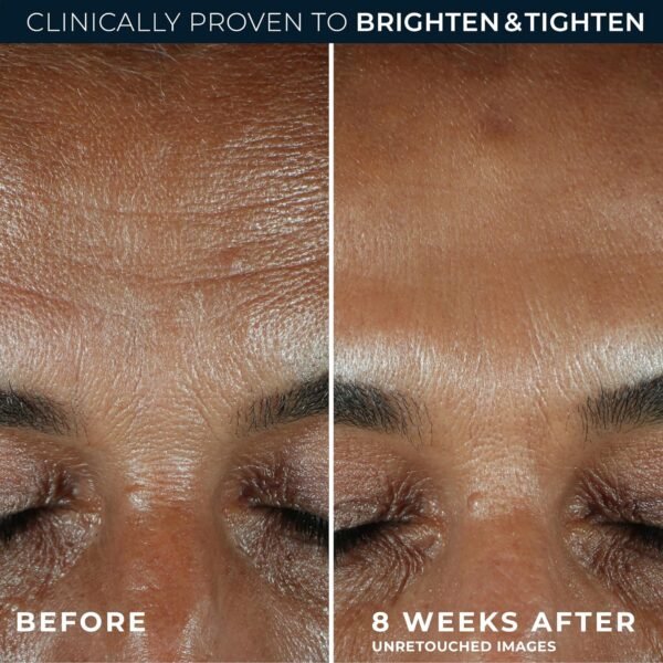 81lwyqGD3rL._SL1500_ RoC Multi Correxion Revive + Glow 10% Active Vitamin C Serum for Face, Daily Anti-Aging Wrinkle and Skin Tone Skin Care Treatment, Brightening Serum, 1 Fluid Ounce