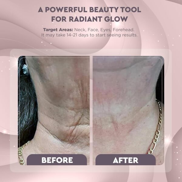 81q5bzdfpNL._AC_SL1500_ GLO24K Red Light Therapy for Face and Neck Beauty Device – Triple Led Action & Vibration Technology Facial Massager and Neck Tightening Device for Turkey Neck, Thermal Face and Neck Massager for Women