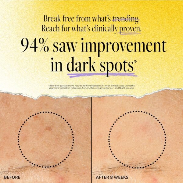 91lMfXXnKUL._SL1500_ DERMA-E Vitamin C Intense Night Cream – Brightening and Hydrating Facial Skin Renewing Cream – Anti-Aging Overnight Facial Moisturizer, 2 oz